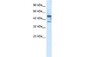 WB Suggested Anti-CHST4 Antibody Titration:  1. (CHST4 抗体  (Middle Region))