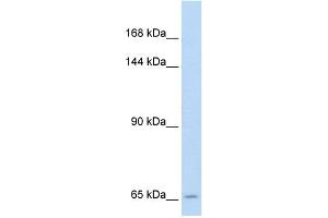 Western Blotting (WB) image for anti-Solute Carrier Family 19 (Folate Transporter), Member 1 (SLC19A1) (N-Term) antibody (ABIN2781749)