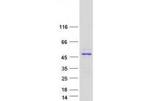 Western Blotting (WB) image for BRISC and BRCA1 A Complex Member 1 (BABAM1) (Transcript Variant 2) protein (Myc-DYKDDDDK Tag) (ABIN2725838)