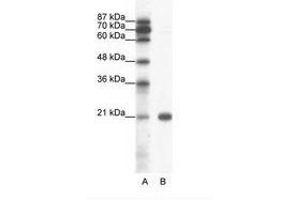 Image no. 1 for anti-Synovial Sarcoma, X Breakpoint 2 (SSX2) (C-Term) antibody (ABIN6736051) (SSX2 抗体  (C-Term))
