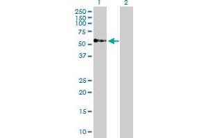 Western Blot analysis of TOM1 expression in transfected 293T cell line by TOM1 MaxPab polyclonal antibody.
