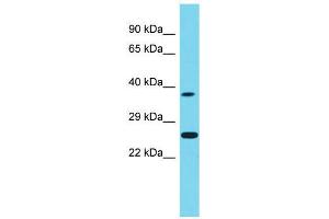 Host:  Rabbit  Target Name:  Neurog1  Sample Type:  Rat Testis lysates  Antibody Dilution:  1. (Neurogenin 1 抗体  (Middle Region))