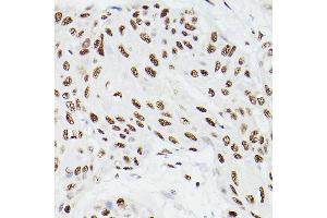 Immunohistochemistry (IHC) image for anti-Cleavage and Polyadenylation Specific Factor 6, 68kDa (CPSF6) antibody (ABIN6138974)