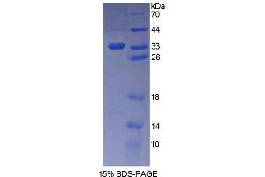 SDS-PAGE analysis of Human KATNA1 Protein.