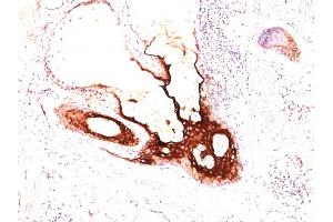 Formalin-fixed, paraffin-embedded human skin stained with CK17 Monoclonal Antibody (SPM560). (KRT17 抗体)