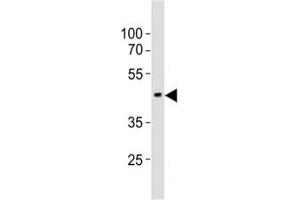 Western blot testing of EED antibody at 1:1000 dilution + mouse brain lysate; Predicted molecular weight: 50 kDa (isoform 1), 53 kDa (isoform 2), 46 kDa (isoform 3). (EED 抗体  (N-Term))