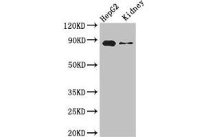 Western Blot Positive WB detected in: HepG2 whole cell lysate, Mouse kidney tissue All lanes: CPT1A antibody at 3. (CPT1A 抗体  (AA 301-600))