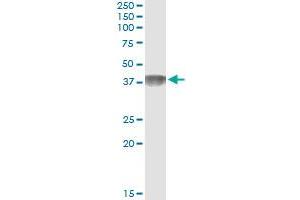 Immunoprecipitation of C4BPB transfected lysate using anti-C4BPB monoclonal antibody and Protein A Magnetic Bead , and immunoblotted with C4BPB MaxPab rabbit polyclonal antibody. (C4BPB 抗体  (AA 1-251))