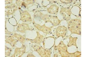 Immunohistochemistry of paraffin-embedded human kidney using  in 30 μg/mL dilute concentrations. (CD14 抗体)
