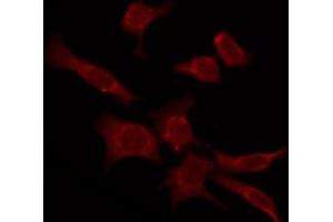 ABIN6276103 staining COLO205 by IF/ICC. (OPN4 抗体  (C-Term))