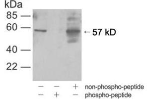 Western blot analysis of cell lysates from HEK-293 cells treated with UVusing Rabbit Anti-Akt (Phospho-Ser473) Polyclonal Antibody (ABIN398632) (AKT1 抗体  (pSer473))