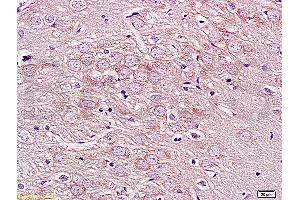 Formalin-fixed and paraffin embedded rat brain labeled with Rabbit Anti GPRIN1 Polyclonal Antibody, Unconjugated (ABIN872320) at 1:200 followed by conjugation to the secondary antibody and DAB staining (GPRIN1 抗体  (AA 101-200))
