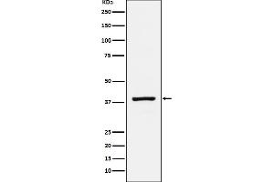 Western blot analysis of RASSF1 expression in HeLa cell lysate.