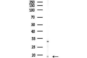 anti-Cyclin-Dependent Kinase Inhibitor 2C (p18, Inhibits CDK4) (CDKN2C) (C-Term) antibody
