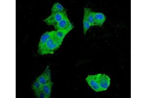 IF analysis of EEF2 using anti-EEF2 antibody (ABIN7603141).