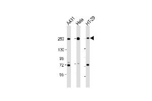 Western Blot at 1:2000 dilution Lane 1: A431 whole cell lysate Lane 2: Hela whole cell lysate Lane 3: HT-29 whole cell lysate Lysates/proteins at 20 ug per lane. (Myosin 9 抗体  (C-Term))