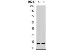 Western blot analysis of MYL9 expression in Jurkat (A), COLO205 (B) whole cell lysates. (MYL9 抗体  (N-Term))