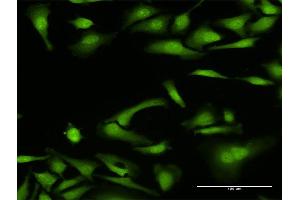 Immunofluorescence of purified MaxPab antibody to NCF4 on HeLa cell. (NCF4 抗体  (AA 1-339))