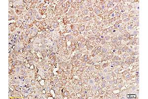 Formalin-fixed and paraffin embedded rabbit liver tissue labeled with Rabbit Anti-TIMP-1(NT) Polyclonal Antibody, Unconjugated (ABIN668331) at 1:200 followed by conjugation to the secondary antibody and DAB staining. (TIMP1 抗体  (AA 103-207))