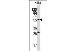 Western blot analysis of anti-CLIC5 Antibody in K562 cell line lysates (35ug/lane). (CLIC5 抗体)
