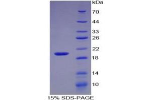 SDS-PAGE of Protein Standard from the Kit  (Highly purified E. (IL-17 ELISA 试剂盒)