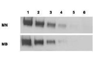 Western Blotting (WB) image for anti-Mesothelin (MSLN) (Extracellular Domain) antibody (ABIN400815) (Mesothelin 抗体  (Extracellular Domain))