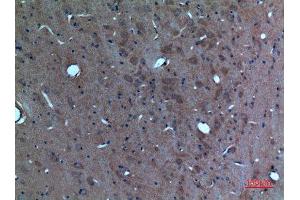 Immunohistochemistry (IHC) analysis of paraffin-embedded Rat Brain, antibody was diluted at 1:100. (SCG3 抗体  (N-Term))