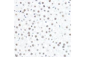 Immunohistochemistry of paraffin-embedded rat liver using SP1 Rabbit pAb (ABIN7270506) at dilution of 1:50 (40x lens). (SP1 抗体  (AA 420-620))