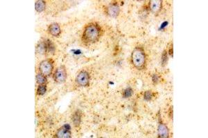Immunohistochemical analysis of CD226 staining in human brain formalin fixed paraffin embedded tissue section. (CD226 抗体  (C-Term))