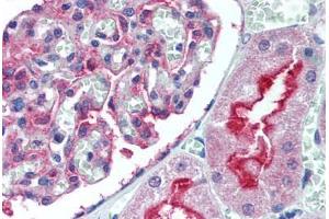 Human Kidney (formalin-fixed, paraffin-embedded) stained with ATG7 antibody ABIN305896 at 5 ug/ml followed by biotinylated goat anti-rabbit IgG secondary antibody ABIN481713, alkaline phosphatase-streptavidin and chromogen. (ATG7 抗体  (N-Term))