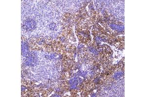 IHC analysis of VCAM1 using anti-VCAM1 antibody . (VCAM1 抗体  (AA 25-270))