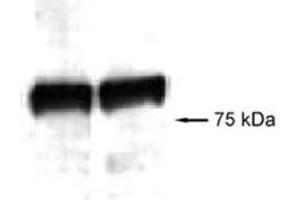 Western blot analysis of Aggf1 in mouse skin protein extracts using Aggf1 polyclonal antibody . (AGGF1 抗体)