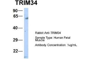 Host:  Rabbit  Target Name:  TRIM34  Sample Type:  Human Fetal Muscle  Antibody Dilution:  1.