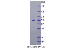 SDS-PAGE analysis of Mouse FPGT Protein. (FPGT 蛋白)