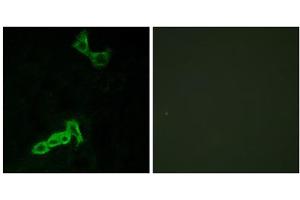 Immunofluorescence analysis of MCF-7 cells, using GPR137C antibody. (GPR137C 抗体  (Internal Region))