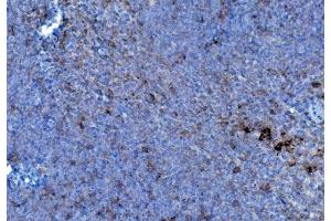 IHC analysis of P4HB using anti-P4HB antibody (ABIN7600075). (P4HB 抗体  (AA 146-363))