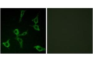Immunofluorescence analysis of LOVO cells, using OR2AG1/2AG2 Antibody. (OR2AG1+2 (AA 61-110) 抗体)