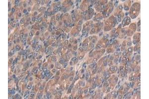 IHC-P analysis of Mouse Stomach Tissue, with DAB staining. (SLIT3 抗体  (AA 1348-1517))