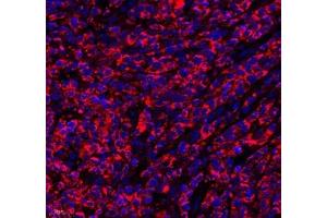 Immunofluorescence of paraffin embedded human lymphoma using septin1 (ABIN7074453) at dilution of 1: 650 (400x lens) (LARP1 抗体)