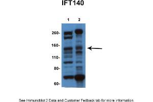 Sample Type: 1. (IFT140 抗体  (N-Term))
