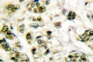 Image no. 2 for anti-Protein Kinase, AMP-Activated, alpha 1 Catalytic Subunit (PRKAA1) (pSer485), (pSer491) antibody (ABIN317958)