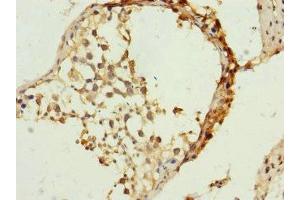 Immunohistochemistry of paraffin-embedded human testis tissue using ABIN7159905 at dilution of 1:100 (TIMM23 抗体  (AA 1-209))