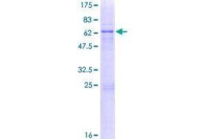 ZC3H14 Protein (AA 1-306) (GST tag)