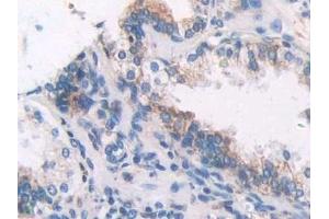 Detection of FBLN1 in Human Prostate Tissue using Polyclonal Antibody to Fibulin 1 (FBLN1)