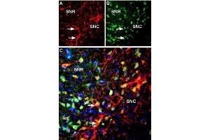 Multiplex staining of Kir3. (Potassium Inwardly-Rectifying Channel, Subfamily J, Member 6 (KCNJ6) Peptide)