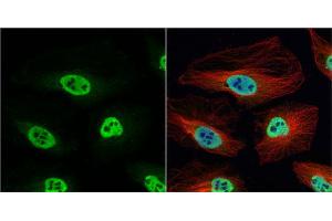 ICC/IF Image hnRNP H antibody [N1C1] detects hnRNP H protein at nucleus by immunofluorescent analysis.