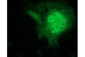 Anti-FGF21 mouse monoclonal antibody (ABIN2454488) immunofluorescent staining of COS7 cells transiently transfected by pCMV6-ENTRY FGF21 (RC204538). (FGF21 抗体  (AA 29-209))