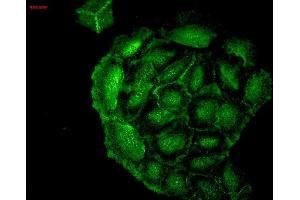 Immunocytochemistry/Immunofluorescence analysis using Mouse Anti-HO-1 Monoclonal Antibody, Clone 1F12-A6 (ABIN361696 and ABIN361697). (HMOX1 抗体  (AA 1-30))