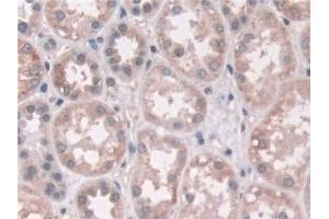 Immunohistochemistry (IHC) image for anti-Aminoadipate Semialdehyde Synthase (AASS) (AA 33-455) antibody (ABIN7444178)