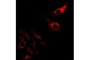 Immunofluorescence (IF) image for anti-serine Peptidase Inhibitor, Kazal Type 1 (SPINK1) antibody (ABIN7308366)